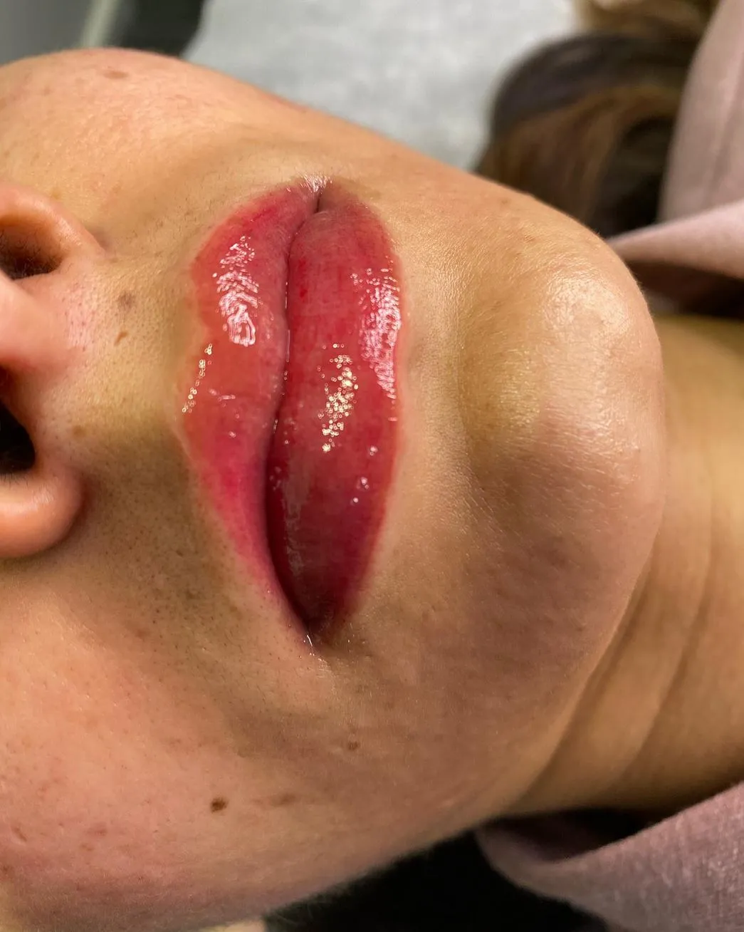 Client Story, When Fading Goes Too Far