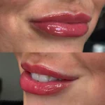 Do Cosmetic Lip Tattoos Completely Fade